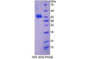 Image no. 1 for Leucine-Rich Repeat LGI Family, Member 3 (LGI3) (AA 261-548) protein (His tag) (ABIN4990874) (LGI3 Protein (AA 261-548) (His tag))