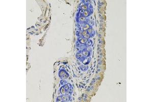 Immunohistochemistry of paraffin-embedded mouse lung using GPHN antibody.