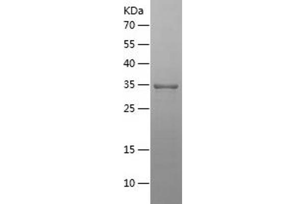 EIF4A2 Protein (AA 1-84) (His-IF2DI Tag)