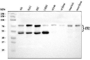 Western blot analysis of ATF2 using anti-ATF2 antibody (ABIN7599413).