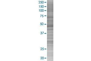 NDUFV1 transfected lysate. (NDUFV1 293T Cell Transient Overexpression Lysate(Denatured))