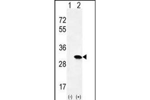Western blot analysis of HRAS (arrow) using rabbit polyclonal HRAS Antibody (C-term) (ABIN655622 and ABIN2845102). (HRAS Antikörper  (C-Term))