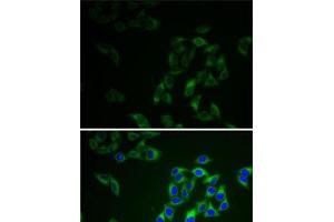 Immunofluorescence analysis of HeLa cells using AK1 Polyclonal Antibody (Adenylate Kinase 1 Antikörper)