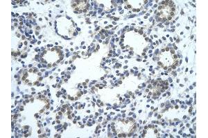 Rabbit Anti-SRBD1 antibody         Paraffin Embedded Tissue:  Human Lung    cell Cellular Data:  alveolar cell    Antibody Concentration:  4.