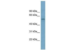 SLC22A15 antibody used at 1 ug/ml to detect target protein. (SLC22A15 Antikörper  (Middle Region))