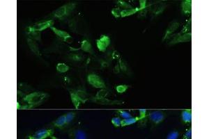 Immunofluorescence analysis of U2OS cells using CXCR5 Polyclonal Antibody at dilution of 1:100. (CXCR5 Antikörper)