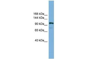 WB Suggested Anti-Hira Antibody Titration:  0. (HIRA Antikörper  (Middle Region))