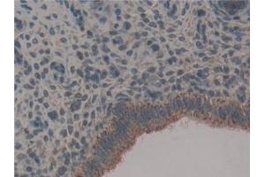 Immunohistochemistry (IHC) image for anti-Heat Shock 60kDa Protein 1 (Chaperonin) (HSPD1) (AA 316-573) antibody (ABIN7440455)