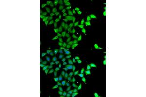 Immunofluorescence analysis of U20S cell using STAM2 antibody.