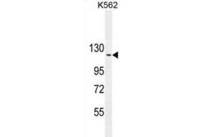 Western Blotting (WB) image for anti-rho GTPase Activating Protein 17 (ARHGAP17) antibody (ABIN2995824) (ARHGAP17 Antikörper)