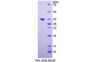 SDS-PAGE (SDS) image for Cyclin-Dependent Kinase 4 (CDK4) (AA 6-295) protein (His tag) (ABIN1878455) (CDK4 Protein (AA 6-295) (His tag))