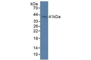 Detection of OAS1 in Rat Stomach Tissue using Polyclonal Antibody to 2',5'-Oligoadenylate Synthetase 1 (OAS1) (OAS1 Antikörper  (AA 139-358))