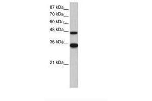 Image no. 1 for anti-General Transcription Factor IIH, Polypeptide 4, 52kDa (GTF2H4) (N-Term) antibody (ABIN202577)