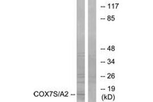 Western blot analysis of extracts from rat heart cells, using COX7S/A2 Antibody. (COX7S/A2 (AA 1-50) Antikörper)