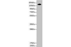 Western blot All lanes: NUP155 antibody at 3. (NUP155 Antikörper  (AA 1102-1391))