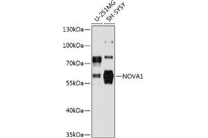 Western blot analysis of extracts of various cell lines, using NOV antibody (2030) at 1:3000 dilution. (NOVA1 Antikörper  (AA 408-507))
