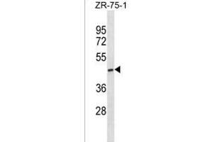 ST6GALNAC5 Antibody (C-term) (ABIN1881843 and ABIN2838433) western blot analysis in ZR-75-1 cell line lysates (35 μg/lane). (ST6GALNAC5 Antikörper  (C-Term))