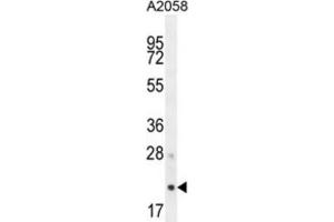 Western Blotting (WB) image for anti-Adaptor-Related Protein Complex 3, sigma 1 Subunit (AP3S1) antibody (ABIN2995675) (AP3S1 Antikörper)