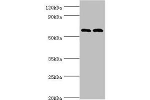 Western blot All lanes: Serine/threonine-protein kinase PAK 2 antibody at 2 μg/mL Lane 1: Jurkat whole cell lysate Lane 2: Hela whole cell lysate Secondary Goat polyclonal to rabbit IgG at 1/10000 dilution Predicted band size: 58 kDa Observed band size: 58 kDa