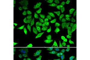 Immunofluorescence analysis of U2OS cells using CCAR2 Polyclonal Antibody (CCAR2 Antikörper)