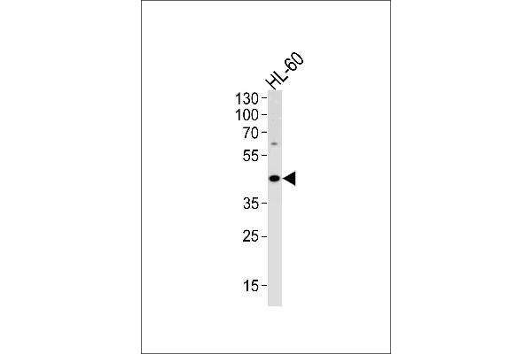 ADA Antikörper  (C-Term)