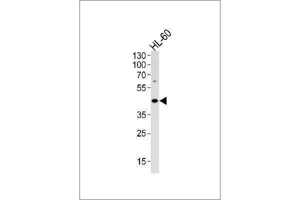 ADA antibody  (C-Term)