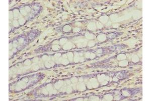Immunohistochemistry of paraffin-embedded human colon tissue using ABIN7165470 at dilution of 1:100 (FAM222B Antikörper  (AA 351-562))