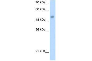 WB Suggested Anti-ONECUT3 Antibody Titration:  1. (ONECUT3 Antikörper  (C-Term))