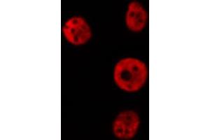 ABIN6274172 staining Hela cells by IF/ICC. (IRF2 Antikörper  (Internal Region))