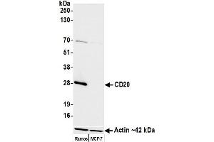 Western Blotting (WB) image for anti-Membrane-Spanning 4-Domains, Subfamily A, Member 1 (MS4A1) antibody (ABIN7449560) (CD20 Antikörper)