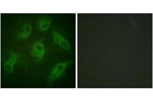 Immunofluorescence analysis of HeLa cells, using MAP4 (Ab-696) Antibody. (MAP4 Antikörper  (AA 662-711))