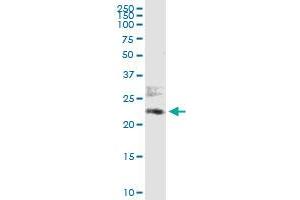 Immunoprecipitation of ATF6 transfected lysate using anti-ATF6 MaxPab rabbit polyclonal antibody and Protein A Magnetic Bead , and immunoblotted with ATF6 purified MaxPab mouse polyclonal antibody (B01P) . (ATF6 Antikörper  (AA 1-202))