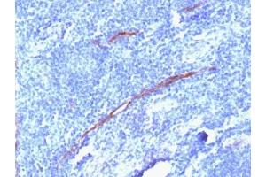 IHC testing of FFPE human tonsil with recombinant CD34 antibody (clone HPCA1/1806R).