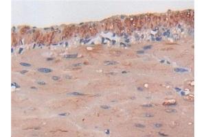 Immunohistochemistry (IHC) image for anti-Thioredoxin Interacting Protein (TXNIP) (AA 30-381) antibody (ABIN7433201)
