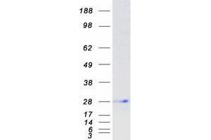 Validation with Western Blot
