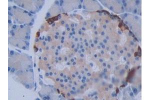DAB staining on IHC-P; Samples: Rat Pancreas Tissue (METTL21C Antikörper  (AA 1-248))