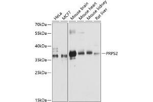Western blot analysis of extracts of various cell lines, using PRPS2 antibody (ABIN6132521, ABIN6146272, ABIN6146274 and ABIN6216352) at 1:3000 dilution. (PRPS2 Antikörper  (AA 1-240))
