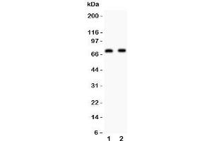 Western blot testing of Numb antibody and Lane 1: human U87;  2: mouse Neuro-2a lysate. (NUMB Antikörper  (AA 194-220))