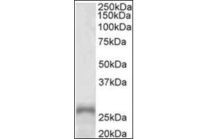 Western Blotting (WB) image for anti-Paired-Like Homeobox 2a (PHOX2A) (AA 165-179), (Internal Region) antibody (ABIN1108647) (PHOX2A Antikörper  (Internal Region))