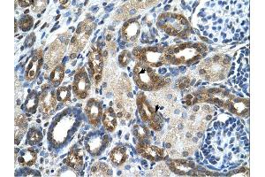 Immunohistochemistry (IHC) image for anti-Pyruvate Kinase, Liver and RBC (PKLR) (N-Term) antibody (ABIN310205) (PKLR Antikörper  (N-Term))