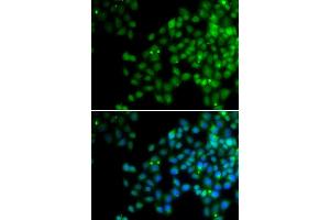 Immunofluorescence analysis of HeLa cell using EPC1 antibody. (EPC1 Antikörper)