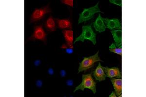 ABIN7094414 and ABIN7098461 staining HepG2 cells by IF/ICC. (OGDHL Antikörper  (Internal Region))