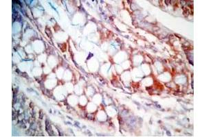 Human colon tissue was stained by Rabbit Anti-CCK (26-33)  (Human,Rat) Antibody (Cholecystokinin Antikörper  (non-sulfated))