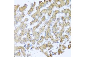 Immunohistochemistry of paraffin-embedded human liver using MOK antibody (ABIN3022550, ABIN3022551, ABIN3022552 and ABIN6218895) at dilution of 1:100 (40x lens). (MOK Antikörper  (AA 1-230))