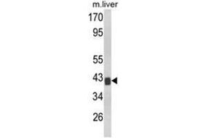 Western blot analysis of TOB1 Antibody (N-term) Cat. (Protein Tob1 (TOB1) (AA 61-91), (N-Term) Antikörper)