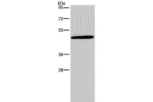 Western Blot analysis of 293T cell using Glucagon Receptor Polyclonal Antibody at dilution of 1:200 (Glucagon Receptor Antikörper)