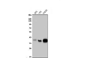 Western blot analysis of MSI1 using anti-MSI1 antibody (ABIN7601349).