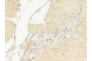ABIN6256870 and ABIN6274846 at 1/100 staining human normal gastric tissue by IHC-P.
