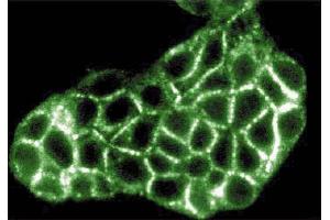 Immunofluorescence staining of MDCK cells (canine kidney, ATCC CCL-34). (ITPR3 Antikörper  (AA 22-230))
