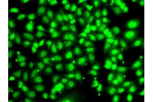 Immunofluorescence analysis of U2OS cells using COPS2 antibody (ABIN5974233). (COPS2 Antikörper)